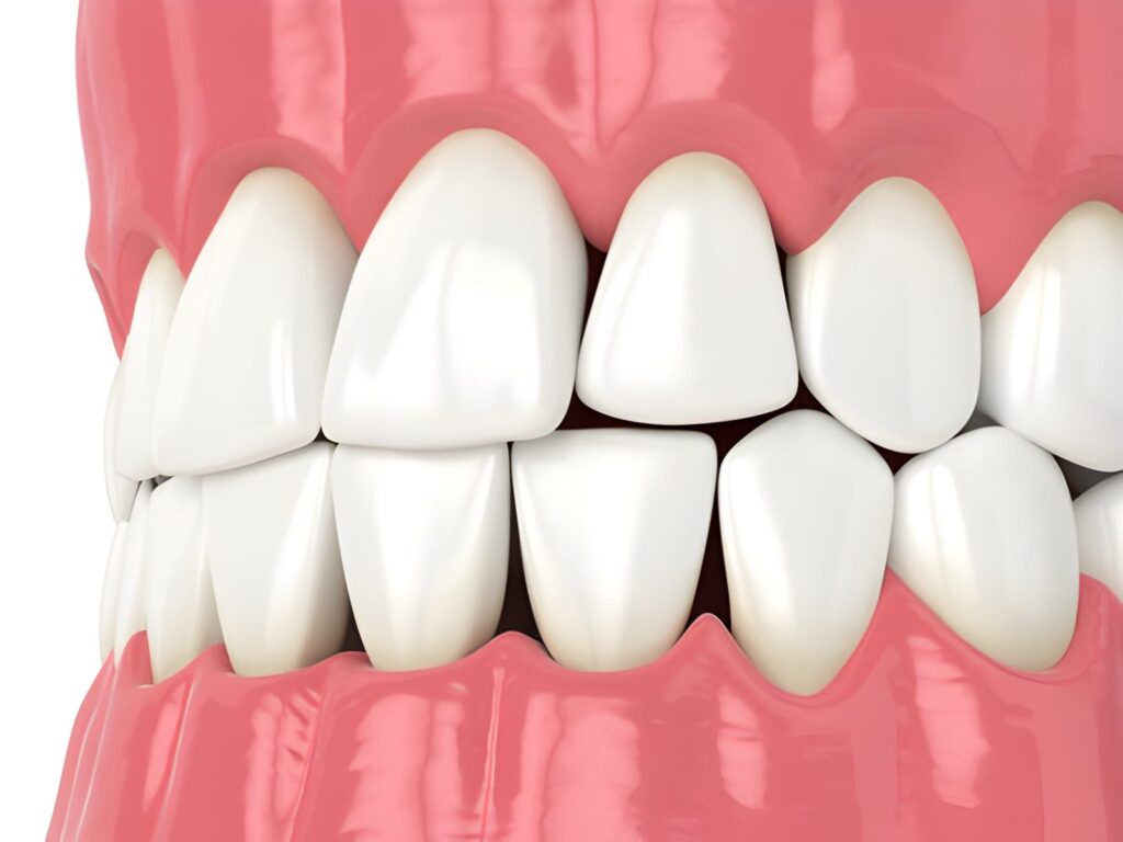 composite bonding cost Scotland