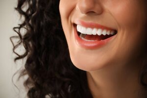 teeth whitening cost Scotland