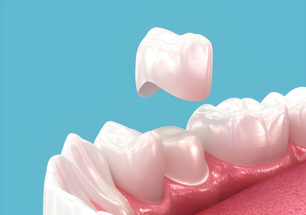 how much does a dental crown cost NHS Scotland